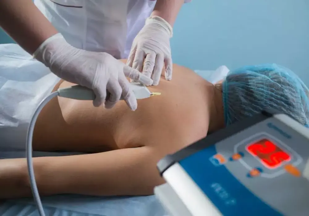 Karboksyterapia na cellulit: Skuteczna metoda na gładką skórę?