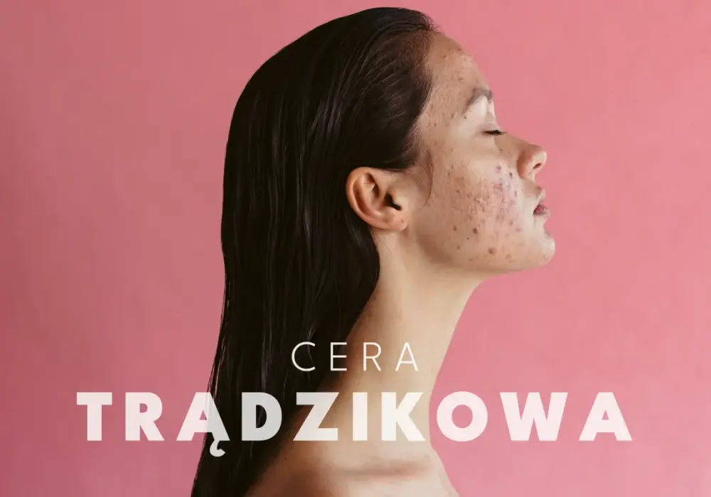 Cera trądzikowa: Jak wybrać kosmetyki i zbudować rutynę?