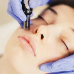 Zabieg dermapenem na twarz. Kosmetolog wykonuje mikronakłuwanie skóry, aby poprawić jej wygląd.