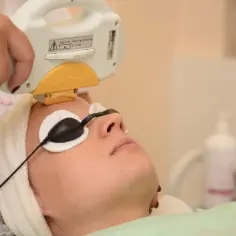 Zabieg laserem IPL na twarz. Kobieta w okularach ochronnych poddaje się fotoodmładzaniu.