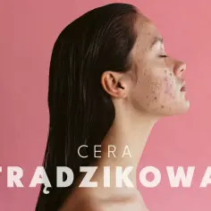 Profil kobiety z cerą trądzikową. Skupienie na problemach skórnych i poszukiwaniu skutecznych kosmetyków.
