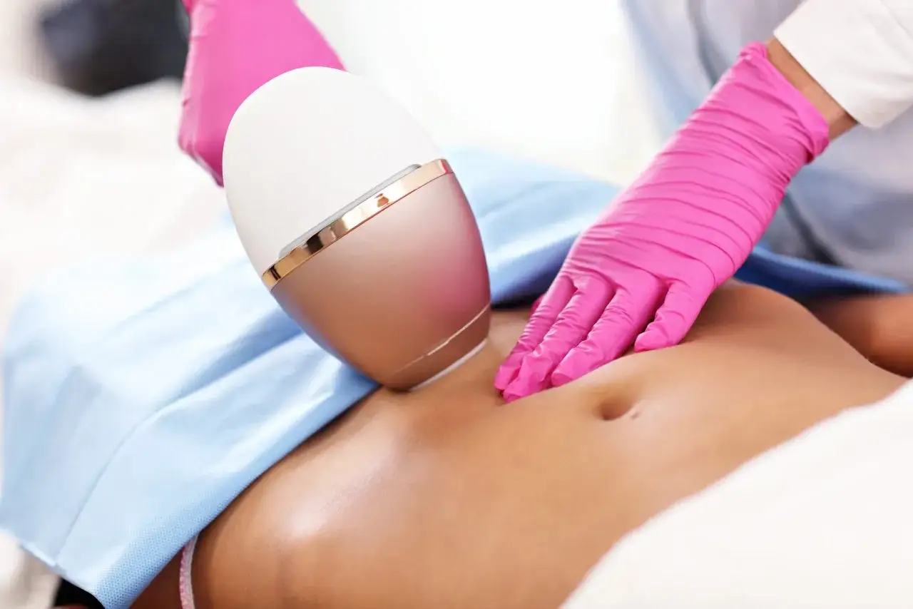 Zabieg depilacji laserowej bikini płytkiego obejmuje okolice pachwin. Dłoń w różowej rękawiczce trzyma urządzenie.