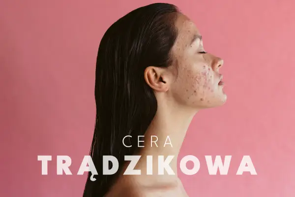 Cera trądzikowa: Jak wybrać kosmetyki i zbudować rutynę?